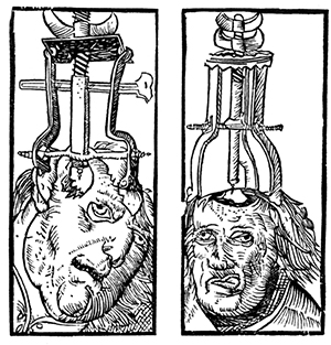 Trepanning is an ancient process, as this 16th century engraving illustrates. Image: Wikimedia Commons