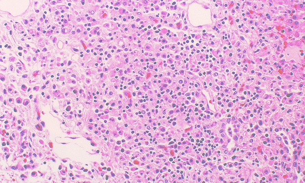 pathology-virus Yale Rosen via Flickr